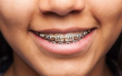 Há uma idade para a ortodontia?